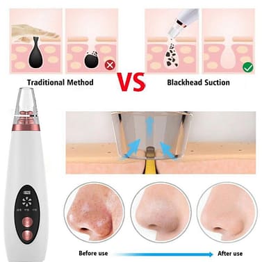 Blackhead Remover Face Pore Vacuum Skin Care Acne Pore Cleaner Pimple Removal Vacuum Suction Facial Tools USB Rechargeable Blackhead Remover Face Pore Vacuum Skin Care Acne Pore Cleaner Pimple Removal Vacuum Suction Facial Tools USB Rechargeable